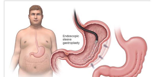 endoscopic-título-1